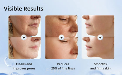Wrinkle Massager for Neck and Face